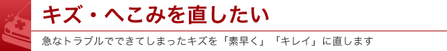 キズ・へこみを直したい