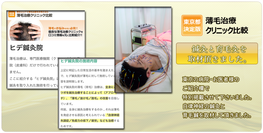 薄毛治療クリニック比較　東京の病院・お医者様のご紹介欄で鍼灸と育毛灸を取材いただきました。